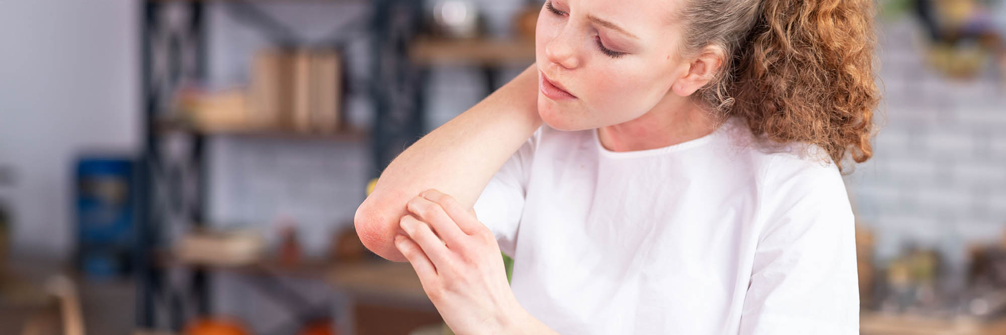 Ringworm: What it is, symptoms and treatments | HealthPartners Blog