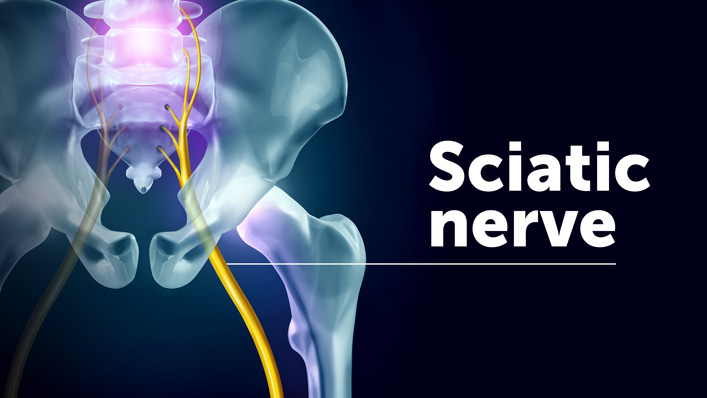 Illustration showing how the sciatic nerves form the lumbar nerves in the lower back.